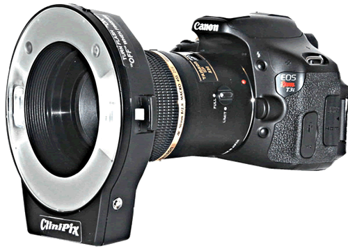 Canon Digital WIreless T3i with ring-flash CliniPix Dental Digital 